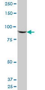 VAV1 Antibody in Western Blot (WB)