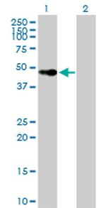 VDR Antibody in Western Blot (WB)