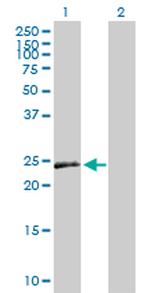 VEGFB Antibody in Western Blot (WB)