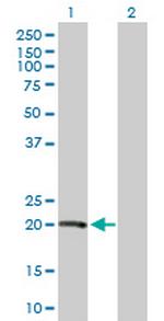 VHL Antibody in Western Blot (WB)