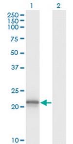 VHL Antibody in Western Blot (WB)