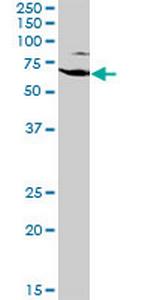 EZR Antibody in Western Blot (WB)