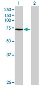 BEST1 Antibody in Western Blot (WB)