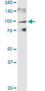 TRPV1 Antibody in Western Blot (WB)