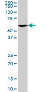 VRK2 Antibody in Western Blot (WB)