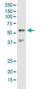 VRK2 Antibody in Western Blot (WB)