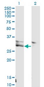 VWF Antibody in Western Blot (WB)