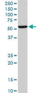 WARS Antibody in Western Blot (WB)