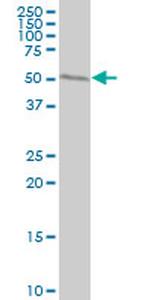 WARS Antibody in Western Blot (WB)