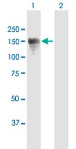 CLIP2 Antibody in Western Blot (WB)