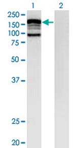 CLIP2 Antibody in Western Blot (WB)