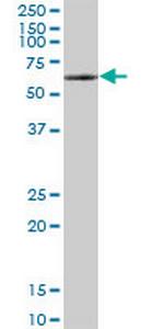 WHSC2 Antibody in Western Blot (WB)