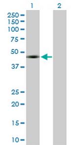 WT1 Antibody in Western Blot (WB)