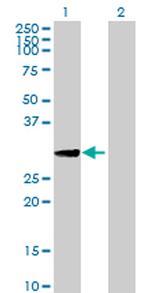 XBP1 Antibody in Western Blot (WB)