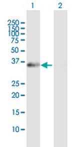 XPA Antibody in Western Blot (WB)