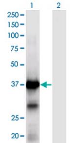 XPA Antibody in Western Blot (WB)