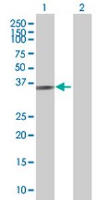 XRCC3 Antibody in Western Blot (WB)