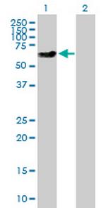 XRCC4 Antibody in Western Blot (WB)