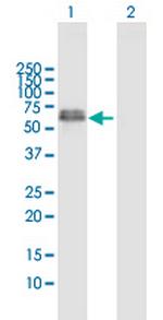 XRCC4 Antibody in Western Blot (WB)