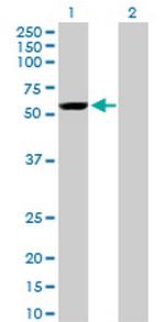 YES1 Antibody in Western Blot (WB)