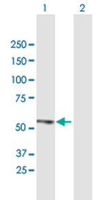 ZFP161 Antibody in Western Blot (WB)