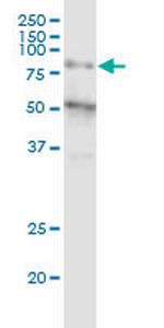 ZNF14 Antibody in Western Blot (WB)