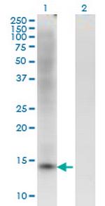 ZBTB16 Antibody in Western Blot (WB)