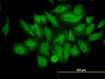 TRIM25 Antibody in Immunocytochemistry (ICC/IF)