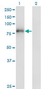 ZNF175 Antibody in Western Blot (WB)