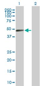 ZNF193 Antibody in Western Blot (WB)