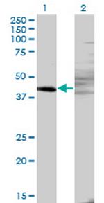 ZNF193 Antibody in Western Blot (WB)