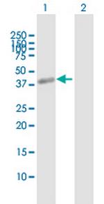 ZP3 Antibody in Western Blot (WB)