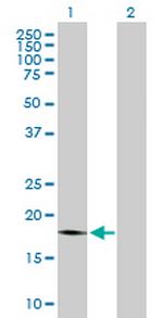 PTP4A1 Antibody in Western Blot (WB)