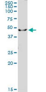 IL1R2 Antibody in Western Blot (WB)