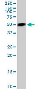 IL1R2 Antibody in Western Blot (WB)