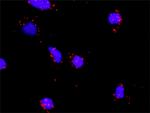 IL1R2 Antibody in Proximity Ligation Assay (PLA) (PLA)