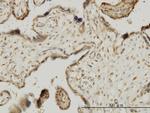 MAPKAPK3 Antibody in Immunohistochemistry (Paraffin) (IHC (P))