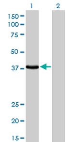 EPM2A Antibody in Western Blot (WB)