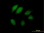 JTV1 Antibody in Immunocytochemistry (ICC/IF)