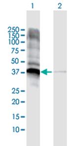 JTV1 Antibody in Western Blot (WB)