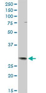 TFPI2 Antibody in Western Blot (WB)