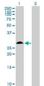 TFPI2 Antibody in Western Blot (WB)