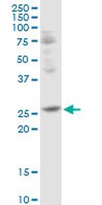 TFPI2 Antibody in Western Blot (WB)