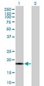 PSCA Antibody in Western Blot (WB)