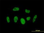 BRD3 Antibody in Immunocytochemistry (ICC/IF)