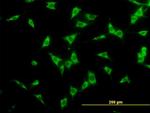 NCOA4 Antibody in Immunocytochemistry (ICC/IF)