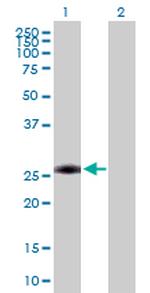 AAAS Antibody in Western Blot (WB)