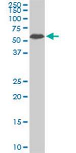 AAAS Antibody in Western Blot (WB)