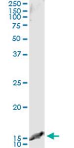 TCL1A Antibody in Immunoprecipitation (IP)