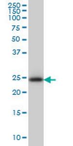 C21orf33 Antibody in Western Blot (WB)